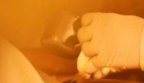 蛇串疮？荨麻疹？皮肤瘙痒？仁爱瑶医邀您体验超赞“三元综合疗法”