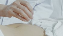 针灸调失眠：从辗转难眠到安稳好眠